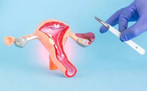 Miyom Ameliyatı Konya